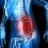 Remedio natural para los dolores de la parte inferior de la espalda